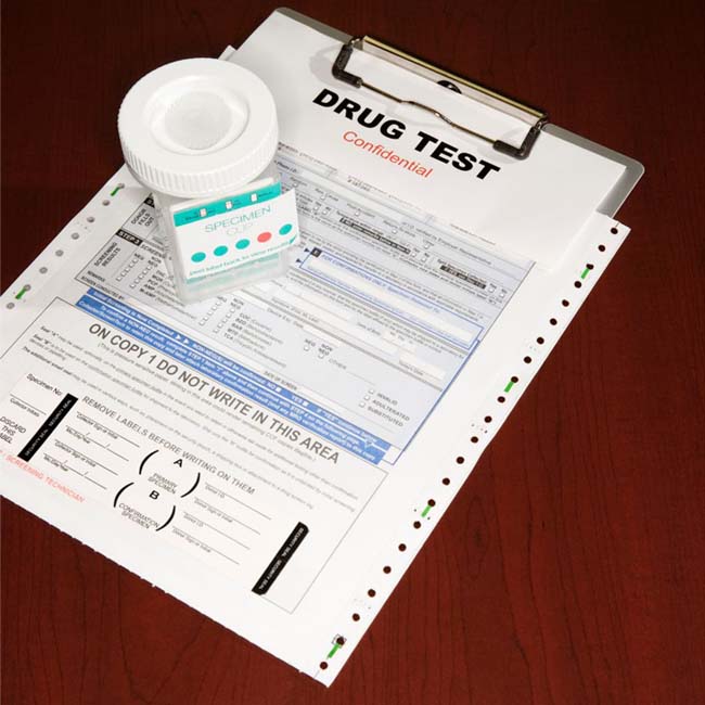 How Long for LabCorp Drug Test (Urine) Results?
